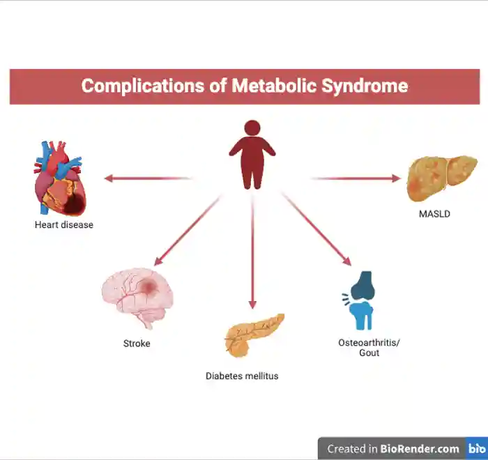 Figure 1: Complications of metabolic syndrome